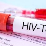 Hiv: salgono a 2 i pazienti remissivi al virus %hiv: salgono a 2 i pazienti remissivi al viruscount(title)% Hiv: salgono a 2 i pazienti remissivi al virus