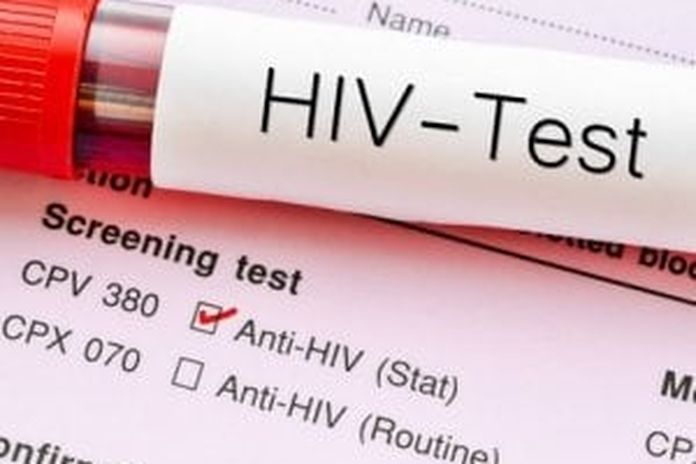 Test rapido HIV