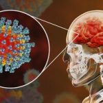 Conseguenze del covid19: attacca il cervello