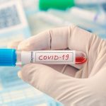 Desametasone: un farmaco da 6 euro contro il covid19