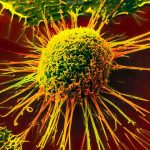 Panseer è la nuova tecnica che riconosce 5 tipi di tumori