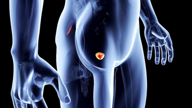 Darolutamide tumore alla prostata