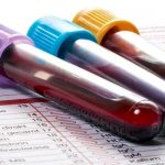 Diagnosticare il cancro: i soggetti c-etac positivi a rischio