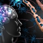 Antinfiammatorio intranasale riduce il progredire della sm