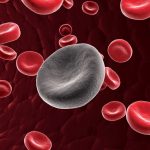 Leucemia: cellule carcick guariscono 6 pazienti