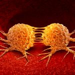 Le cellule tumorali si ibernano per evitare la chemioterapia %le cellule tumorali si ibernano per evitare la chemioterapiacount(title)% Le cellule tumorali si ibernano per evitare la chemioterapia