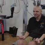 Ecco le braccia robotiche che aiutano i pazienti con lesioni
