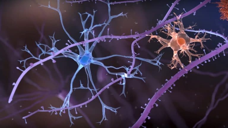 Alzheimer, Fli-1, litio, perdita dei neuroni