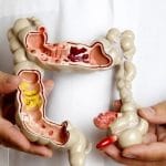 Nanomolecole: nuova terapia per il morbo di crohn? %nanomolecole: nuova terapia per il morbo di crohn? count(title)% Nanomolecole: nuova terapia per il morbo di crohn?