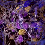 Alzheimer: anticorpo hae-4 rimuove le placche amiloidi %alzheimer: anticorpo hae-4 rimuove le placche amiloidicount(title)% Alzheimer: anticorpo hae-4 rimuove le placche amiloidi