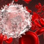 Bortezomib: migliora la sopravvivenza nei bambini con linfoma linfoblastico a cellule