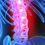 Lesioni midollo spinale riparate con cellule staminali dei pazienti %lesioni midollo spinale riparate con cellule staminali dei pazienticount(title)% Lesioni midollo spinale riparate con cellule staminali dei pazienti