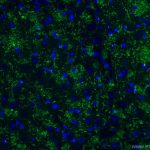 Vglut2: la proteina che regola la neurodegenerazione