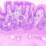 Bioprinting ripara lesioni traumatiche di ossa e pelle