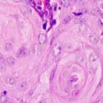 Cancro: ecco il meccanismo che blocca la proliferazione cellulare
