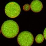 Cellule beta: stimolarne la proliferazione per curare il diabete %cellule beta: stimolarne la proliferazione per curare il diabetecount(title)% Cellule beta: stimolarne la proliferazione per curare il diabete