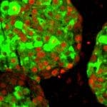Microgel potenzia il trapianto di cellule nel dt1 %microgel potenzia il trapianto di cellule nel dt1count(title)% Microgel potenzia il trapianto di cellule nel dt1