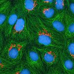 Shread: la terapia genica che spinge il cancro ad autodistruggersi %shread: la terapia genica che spinge il cancro ad autodistruggersicount(title)% Shread: la terapia genica che spinge il cancro ad autodistruggersi