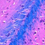 Proteina slc7a11: la chiave che blocca la sclerosi multipla? %proteina slc7a11: la chiave che blocca la sclerosi multipla? Count(title)% Proteina slc7a11: la chiave che blocca la sclerosi multipla?