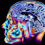 Morte neuronale: scoperta causa nei soggetti con sla familiare %morte neuronale: scoperta causa nei soggetti con sla familiarecount(title)% Morte neuronale: scoperta causa nei soggetti con sla familiare