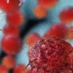 Proteina setdb1 aiuta il cancro ad eludere il sistema immunitario
