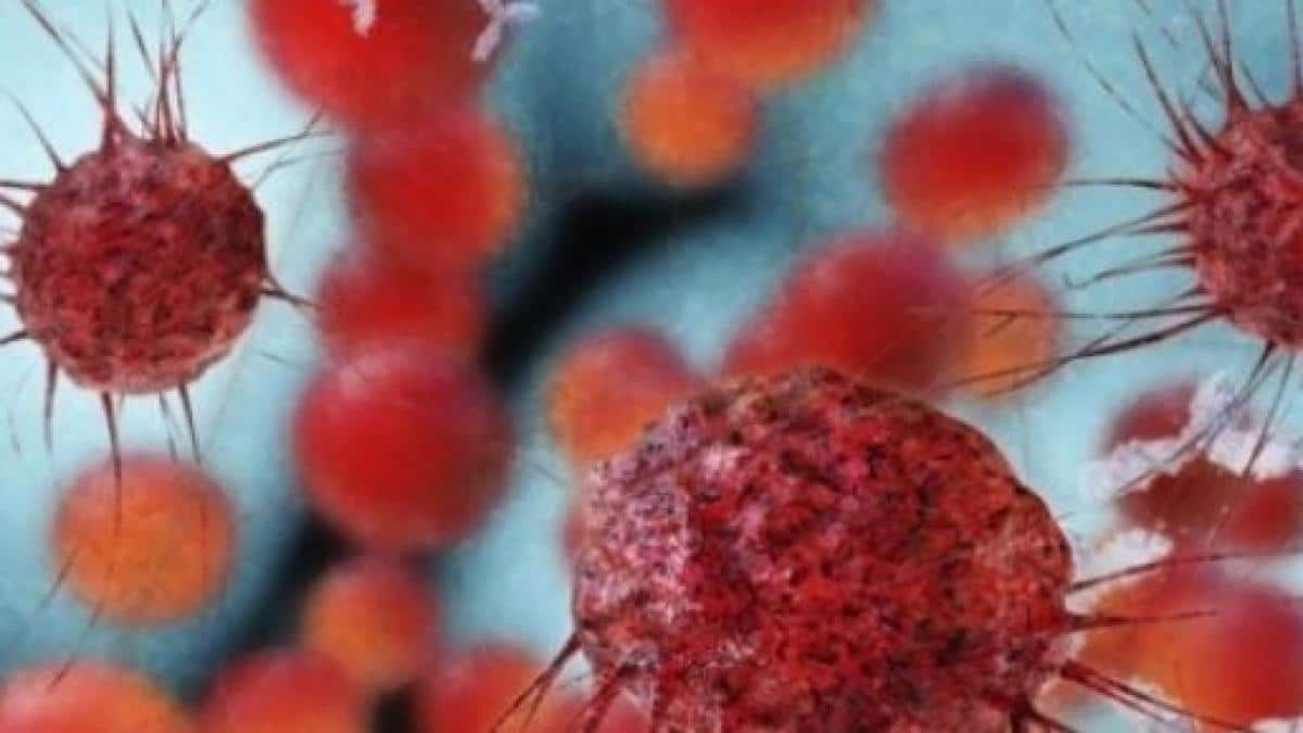 Proteina setdb1 aiuta il cancro ad eludere il sistema immunitario