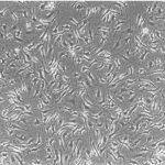 Le cellule immunitarie hanno un ruolo chiave nell'alzheimer