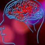 Neuroprotesi permette ad un uomo con paralisi di comunicare %neuroprotesi permette ad un uomo con paralisi di comunicarecount(title)% Neuroprotesi permette ad un uomo con paralisi di comunicare
