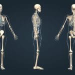Impianto osseo in 3d ripara eventuali lesioni dello scheletro
