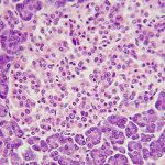 Pillsid: il dispositivo completamente impiantabile per somministrare l'insulina