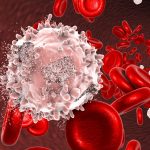 Leucemia linfatica cronica: nuova terapia si mostra efficace