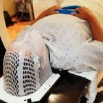 Radioterapia personalizzata: un approccio più efficace