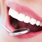 Impianto dentale smart: finalmente durerà 20 anni o più?