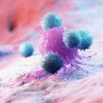 Cellule cancerose cambiano forma e si insinuano in altri tessuti