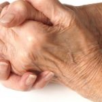 Artrite reumatoide: sviluppato nuovo vaccino sperimentale