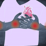 Psoriasi: la glicerina è sicura?
