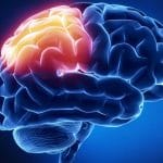 Cvt (trombosi venosa cerebrale): scoperta predisposizione genetica
