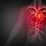 Disfunzione diastolica: nuovo approccio per curarla nei pazienti ar