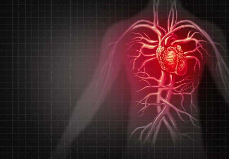 Infarto