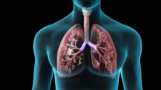 Infezioni polmonari, riparazione del DNA 