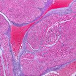 Come rigenerare le cellule che promuovono il battito cardiaco