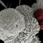 Cancro al pancreas: ecco perché le cellule cancerose sono così aggressive %cancro al pancreas: ecco perché le cellule cancerose sono così aggressive count(title)% Cancro al pancreas: ecco perché le cellule cancerose sono così aggressive