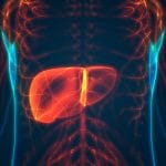 Steatosi epatica non alcolica: scoperto collegamento genetico %steatosi epatica non alcolica: scoperto collegamento geneticocount(title)% Steatosi epatica non alcolica: scoperto collegamento genetico