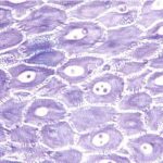 Psoriasi: rintracciate 3 proteine responsabili %psoriasi: rintracciate 3 proteine responsabilicount(title)% Psoriasi: rintracciate 3 proteine responsabili