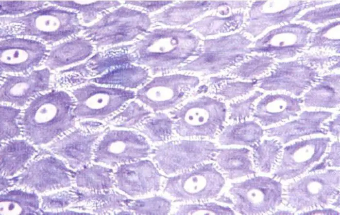 Psoriasi: rintracciate 3 proteine responsabili