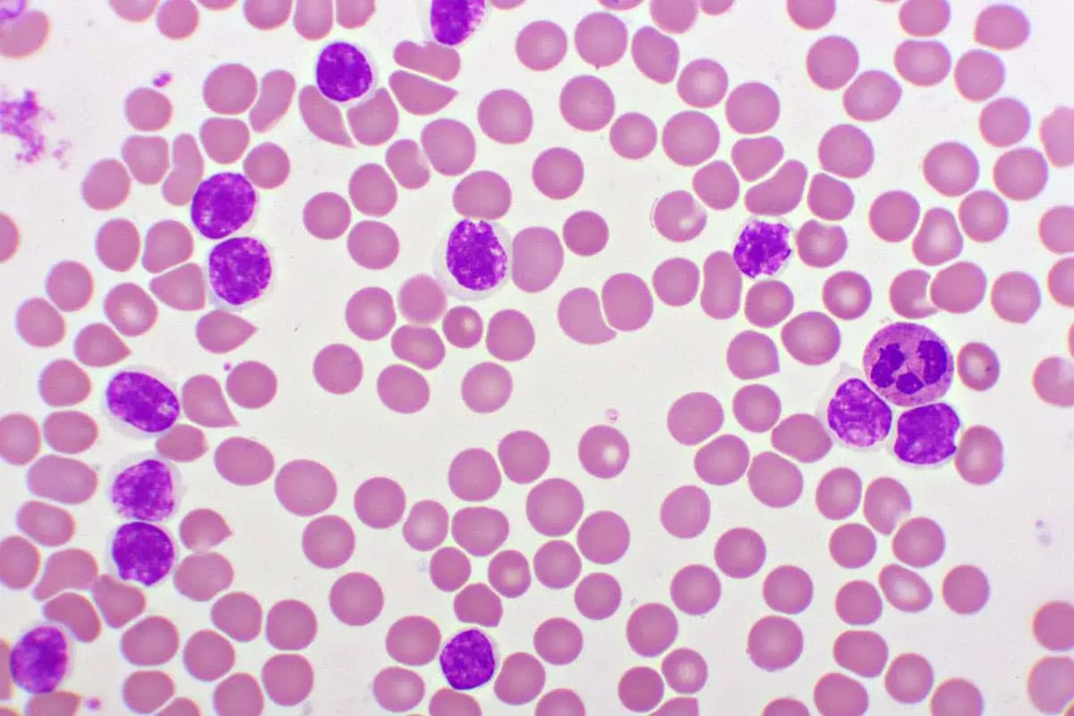 Cd200r1: arriva un nuovo promette approccio per la cura dei tumori ematologici resistenti