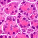 Fabkin: l'ormone critico nel diabete t1 e t2 %fabkin: l'ormone critico nel diabete t1 e t2 count(title)% Fabkin: l'ormone critico nel diabete t1 e t2