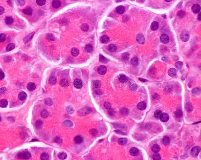 Cellule pancreatiche, isole pancreatiche, Cancro al pancreas