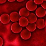 Microrna-210: la molecola correlata ai danni vascolari nel diabete t2 %microrna-210: la molecola correlata ai danni vascolari nel diabete t2count(title)% Microrna-210: la molecola correlata ai danni vascolari nel diabete t2