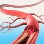 Carne rossa aumenta il rischio di malattie cardiovascolari %carne rossa aumenta il rischio di malattie cardiovascolaricount(title)% Carne rossa aumenta il rischio di malattie cardiovascolari